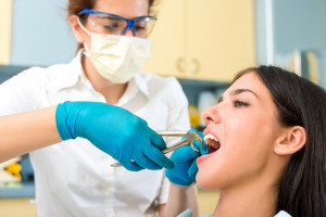 بررسی بهترین زمان و سن برای کشیدن دندان عقل