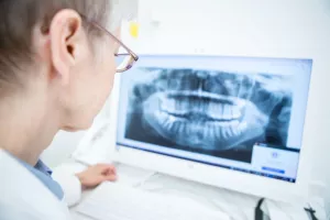 نحوه تشخیص میدلاین دندان و درمان آن