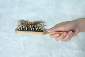 در مورد ریزش موی کششی چه باید بدانیم؟