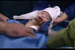 ثبت رکورد جراحی نادر فک و صورت بر روی نوزاد ۲۳ روزه در ایران ! + فیلم جراحی