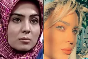 چهره قبل از عمل لیلای سه در چهار با خال روی لب !!