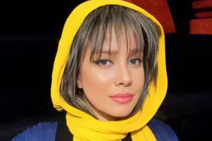 چهره کنفیکون شده شراره رخام قبل از شهرت با دماغ بزرگ و صورت لاغر و ... !