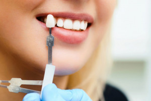 عفونت روکش دندان : چگونه بوی بد روکش دندان را از بین ببریم ؟