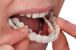 کاور دندان snap on smile چیست و چه کاربردی دارد ؟