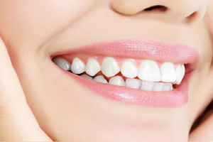طراحی لبخند به چند روش و چگونه انجام میشود ؟