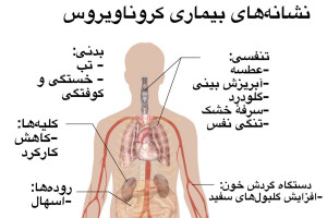 علائم و نشانه های کرونا به چه ترتیبی ظاهر می شوند ؟