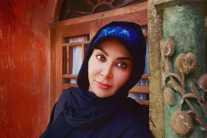 چهره عجیب خانم بازیگر پس از عمل های زیبایی / فقیهه نشناختنی شد !!