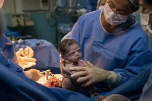 چهره جدید ایزابل روشا نوزاد بی اعصاب برزیلی پس از چند سال