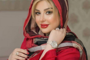چهره ی جدید نیوشا ضیغمی پس از جراحی دوباره بینی