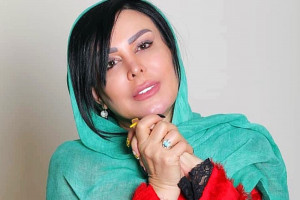 فلور نظری با لب های پروتز شده