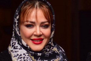 عمل زیبایی بهاره رهنما فقط بوتاکس کردم