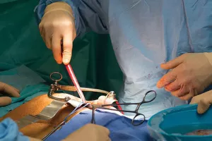 آدرس و تلفن بهترین فوق تخصص جراحی پیوند کلیه در شیراز