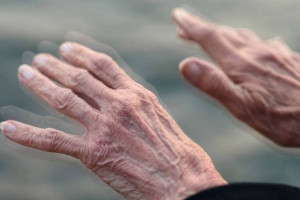درمان بیماری پارکینسون با طب سنتی و داروهای گیاهی