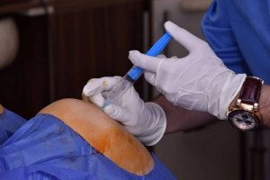 انواع تزریق ژل به زانو : تزریق ژل به زانو چگونه انجام می شود ؟