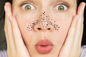 8 راهکار فوق العاده برای جلوگیری از ایجاد جوش های سر سیاه