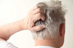 5 روش معجزه آسا برای درمان خشکی پوست سر