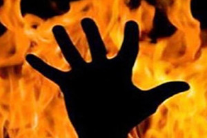 آتش زدن رفیق به خاطر دختری در پارک
