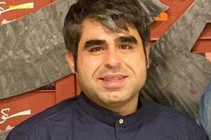 عکس تغییر چهره امیر نوری
