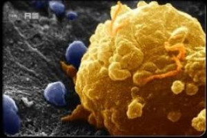 کشف مبانی ژنتیک سرطان کبد در اقوام آسیایی