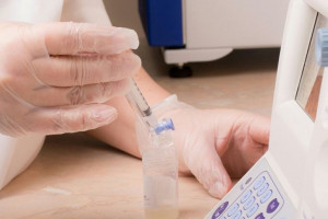 علت بالا و پایین بودن SFA در آزمایش مایع سمینال