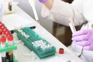 علت بالا و پایین بودن Synovial Fluid آزمایش مایع مفصلی