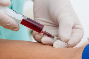 تفسیر آزمایش نیتروژن اوره ی خون (Blood Urea Nitrogen)