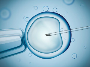 از صفر تا صد مراحل انجام لقاح آزمایشگاهی (IVF)