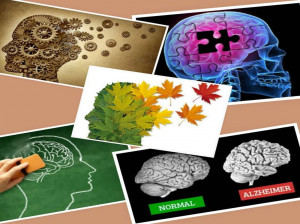 مقایسه بیماری آلزایمر با زوال عقل و تفاوت های آنها