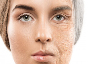 کلاژن چیست ؟ کاربرد و راههای افزایش کلاژن در بدن