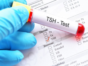 TSH در آزمایش خون