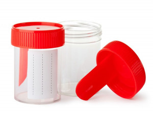 Yeast در آزمایش مدفوع : علائم وجود Yeast (مخمر) در مدفوع چیست ؟