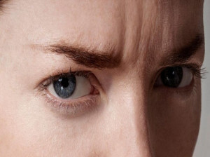 از بین بردن خط اخم ابرو با روشهای طبیعی