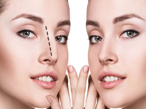 برای از بین بردن ترس و استرس عمل بینی چه کار کنیم ؟