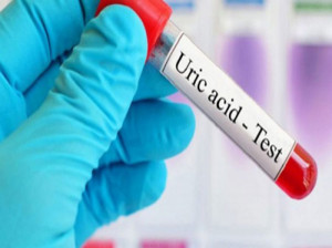 بررسی و تفسیر جواب (Uric Acid) خون