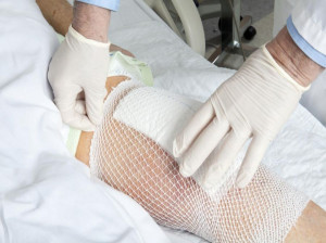 عفونت تعویض مفصل زانو : درمان عفونت بعد از عمل تعویض مفصل زانو