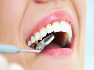 تفاوت کامپوزیت با لمینت دندان | مزیت و معایب هر کدام