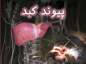 عوارض پیوند کبد چیست ؟ آشنایی با شرایط جراحی پیوند کبد