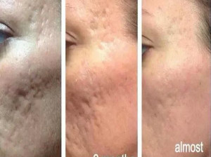همه چیز درباره سابسیژن و سابسیژکتور