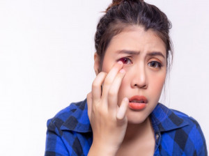 دلیل ایجاد عارضه کموسیس چشمی چیست ؟