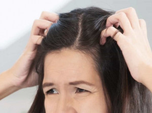 ۱۴ علت اصلی بروز زخم پوست سر چیست ؟