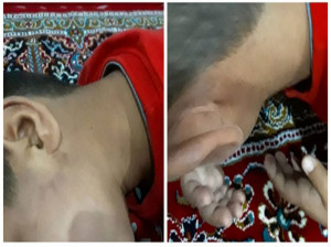 ماجرای شکنجه ابوالفضل 7 ساله در مدرسه/ از مدرسه می ترسد!