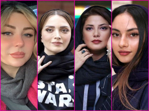 بازیگران زن ایرانی قبل عمل زیبایی / باور کردنی نیست!