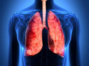 پزشکان فوق تخصص ریه در سمنان به همراه آدرس و تلفن
