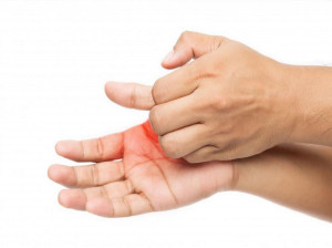 خارش پوست در نقاط مختلف بدن نشانه چیست ؟
