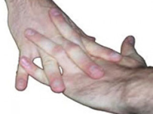 آیا شکستن انگشتان مضر است؟