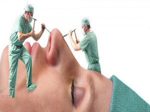 همه چیز درباره عمل زیبایی بینی