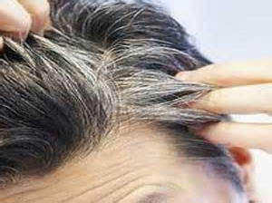 چرا موهایمان زود سفید می شود؟
