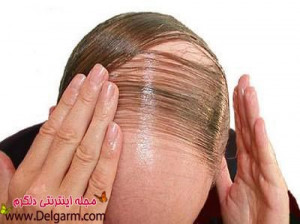 جلوگیری از ریزش مو و دلیل ریزش مو