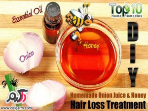 درمان طبیعی ریزش مو با آب پیاز و عسل 
