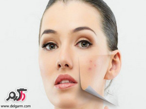 چگونه چرب شدن پوست را به عقب بیندازیم؟